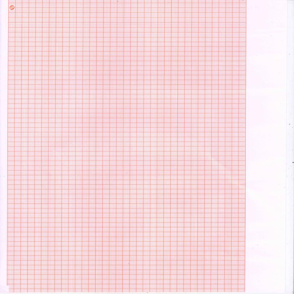 Stress Test ECG TMT Paper