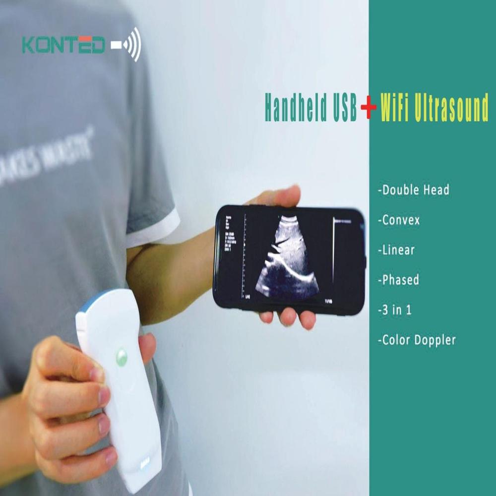 Hand Held Ultrasou Color Doppler Machine