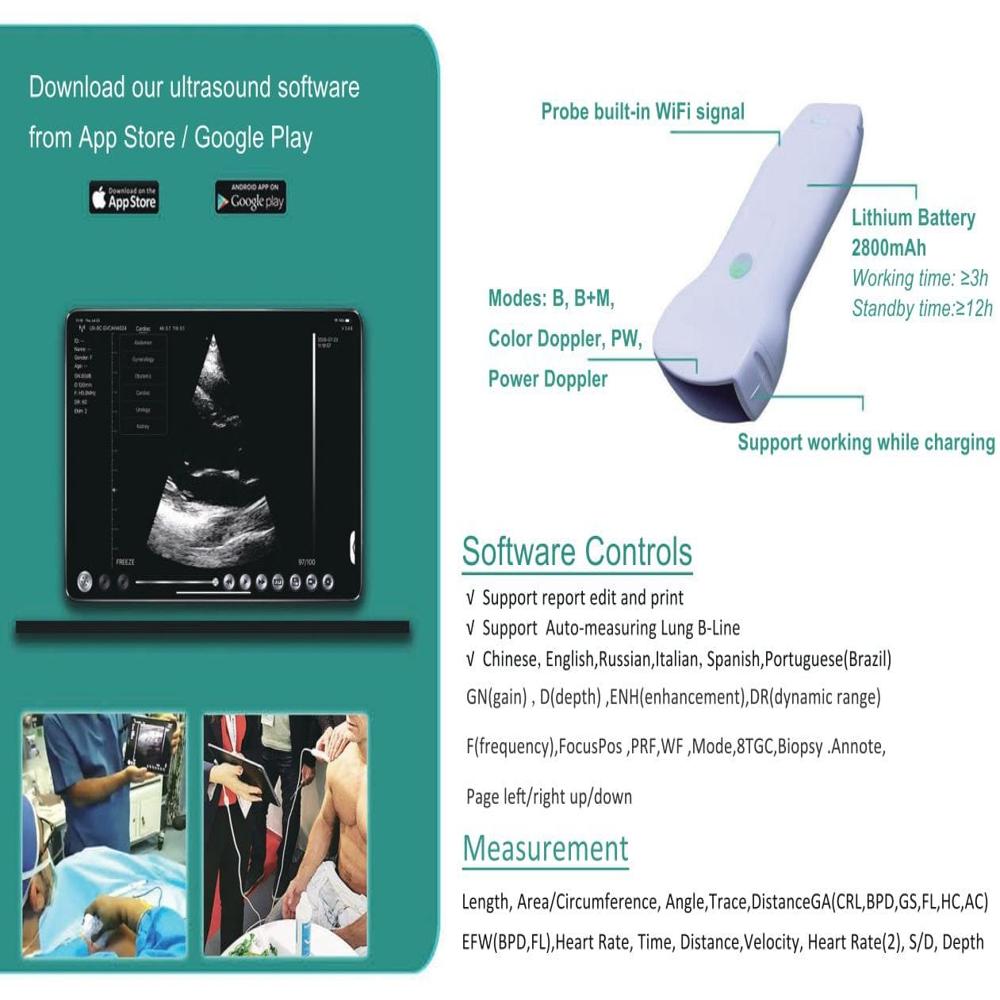 Hand Held Ultrasou Color Doppler Machine