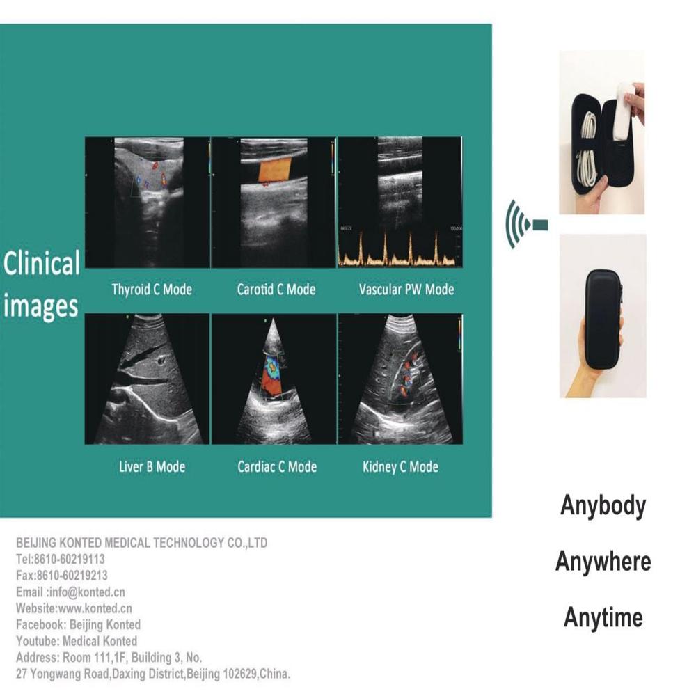Hand Held Ultrasou Color Doppler Machine