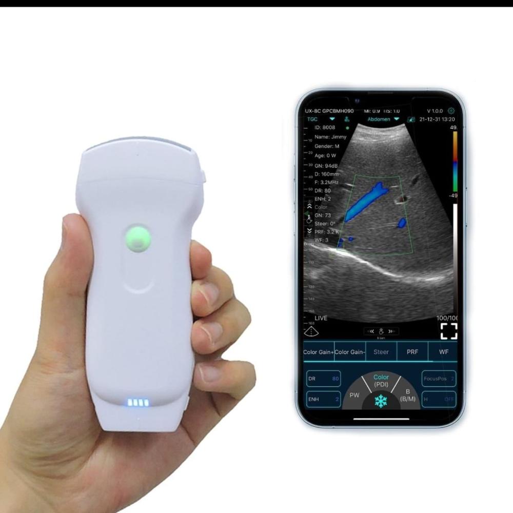 Hand Held Ultrasou Color Doppler Machine