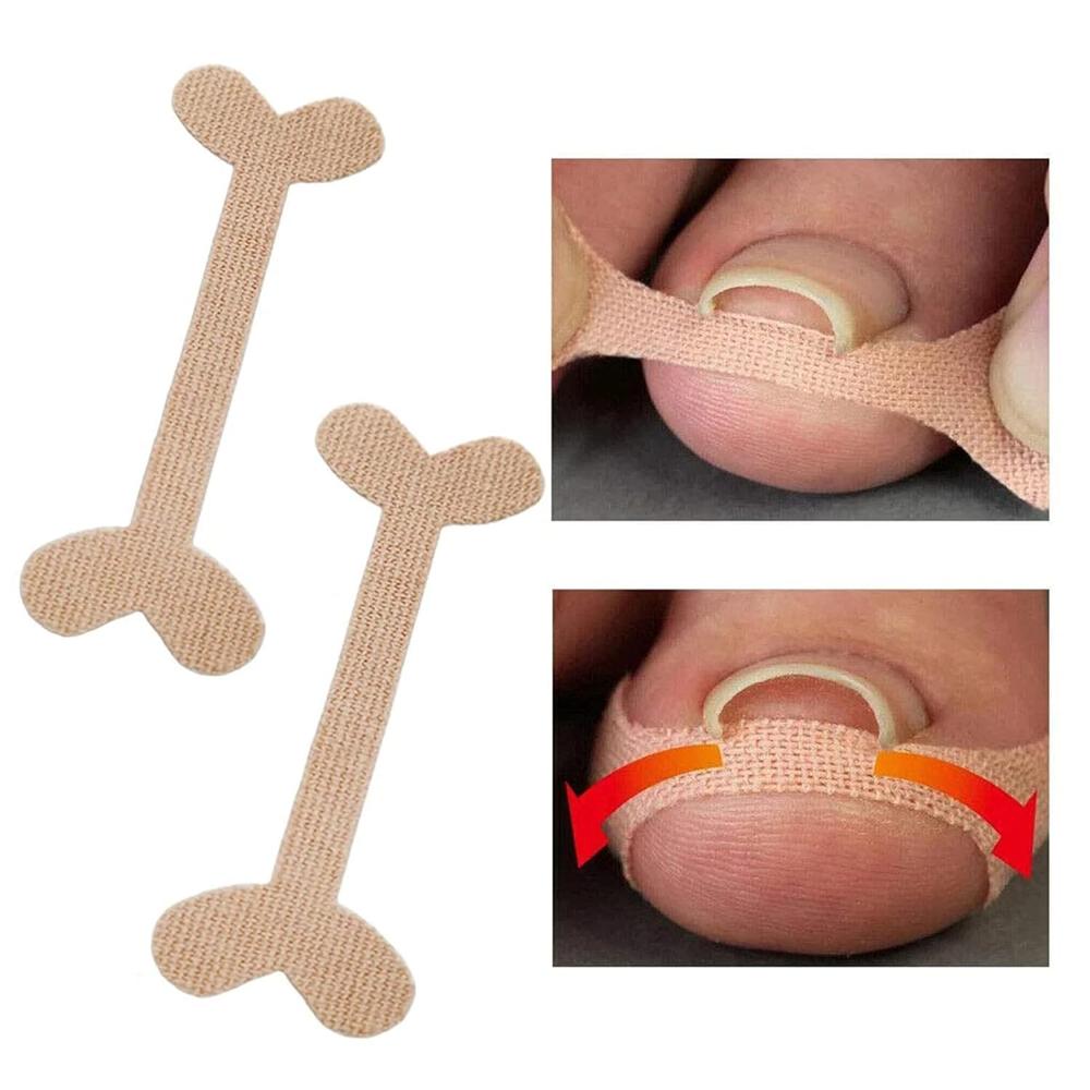 Ingrown Toenail Corrector Stickers
