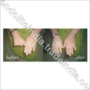 सिलिकोन उंगलियाँ