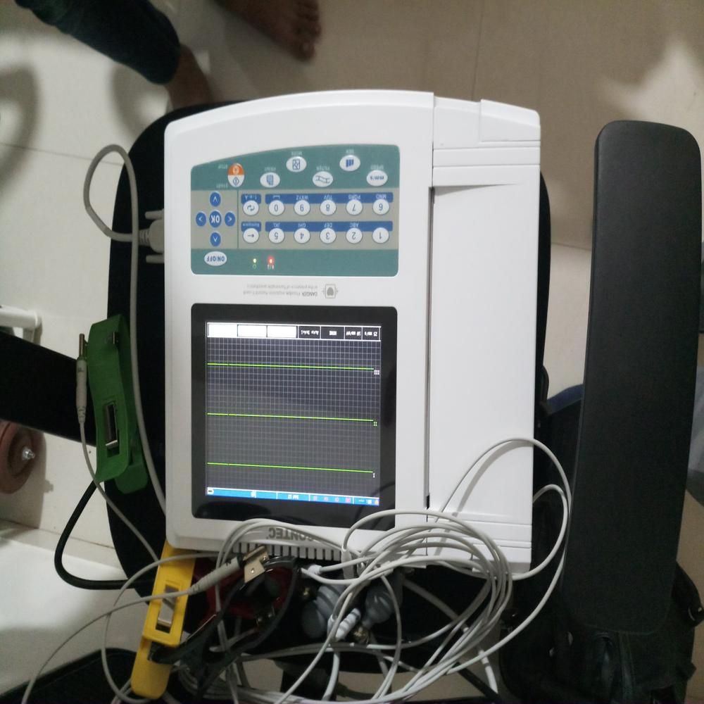 12 Channel ECG Machine