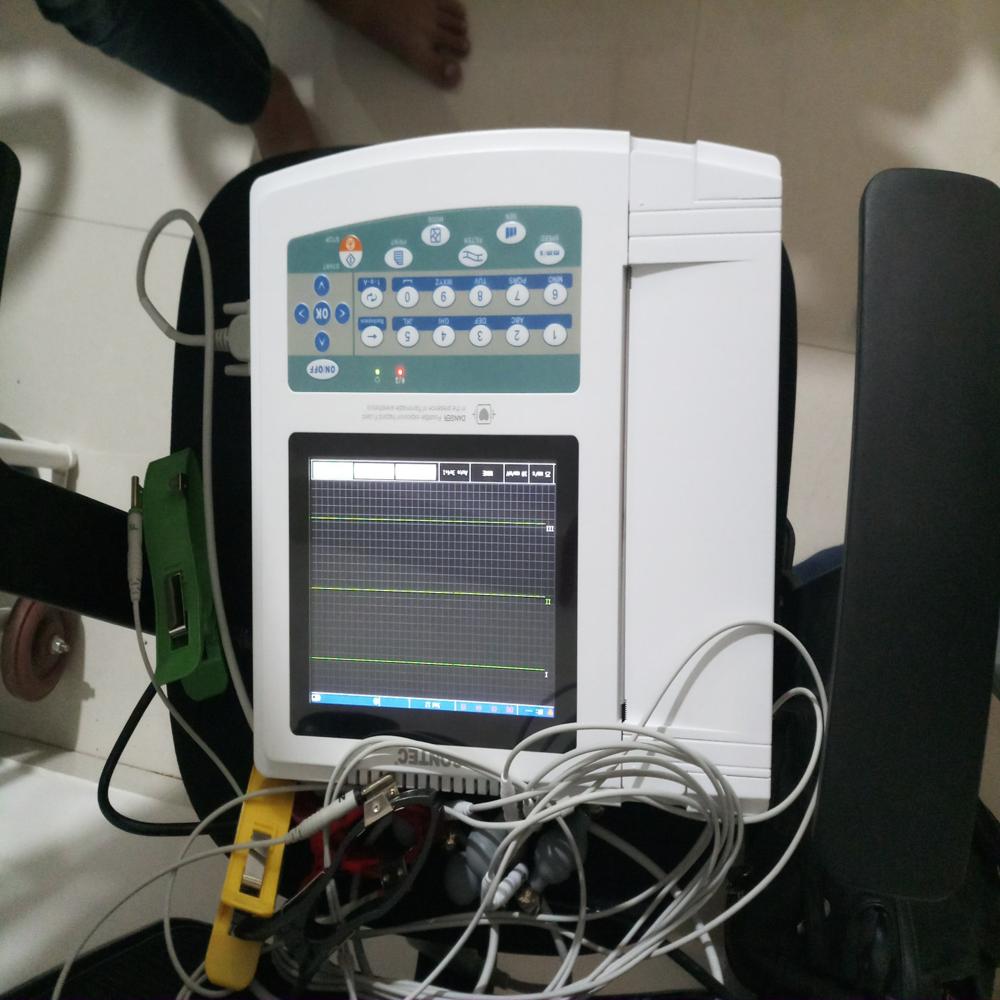 12 Channel ECG Machine