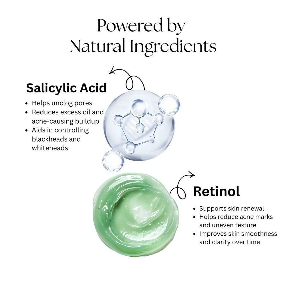 Acne Care Cream Kayee Ayurveda