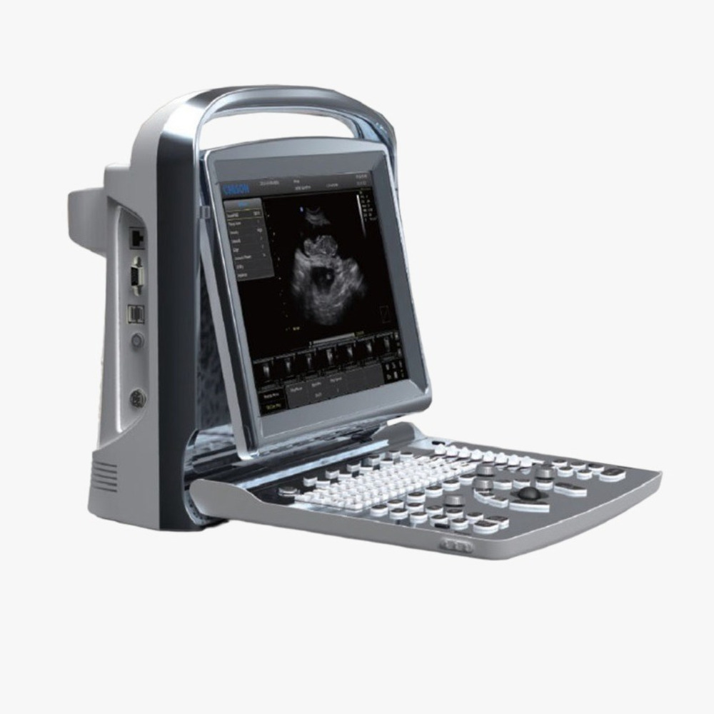 Tm-Sonography Portable Ultrasound Machine