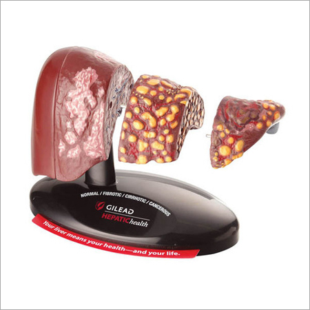 प्लास्टिक फोर स्टेज लिवर मॉडल