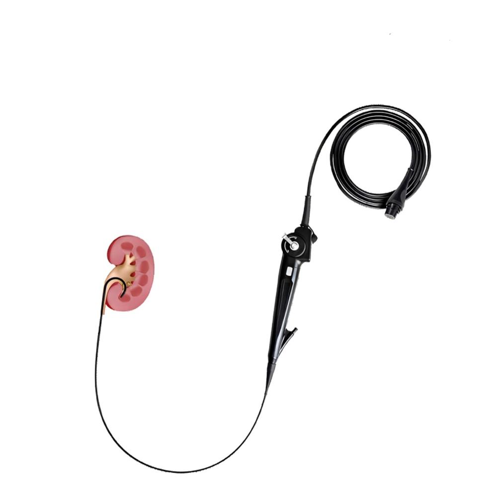 Flexible Disposable Ureteroscope Single-Use Ureteroscope Digital Flexible Ureteroscope