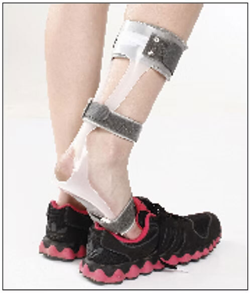 D-17 Foot Drop Splint