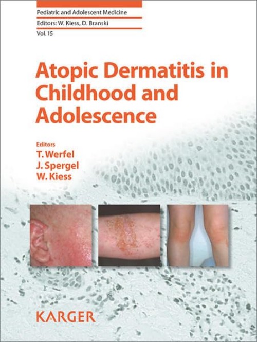 Atopic Dermatitis in Childhood and Adolescence Book 