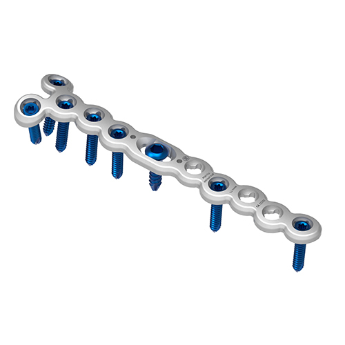 2.4 mm VA Volar Distal Ulna LCP