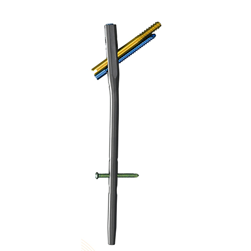 Cannulated Humerus Nail
