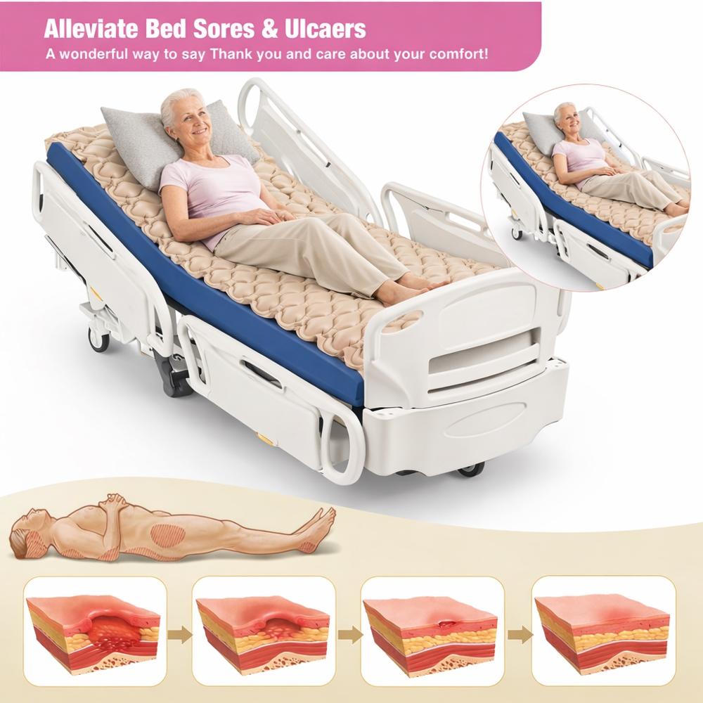 AMKAY Anti-Decubitus Air Bubble Mattress with Pump for Bedsore Prevention, Medical-Grade, 1-Year Warranty