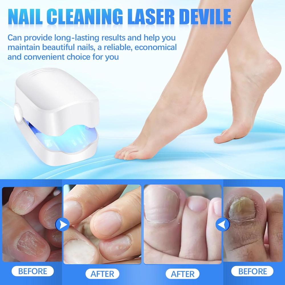 Rechargeable Nail Fungus Laser Anti Fungal Device Toenails, Hands, Feet (Home Use)