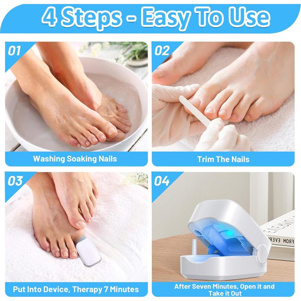 Rechargeable Nail Fungus Laser Anti Fungal Device Toenails, Hands, Feet (Home Use)