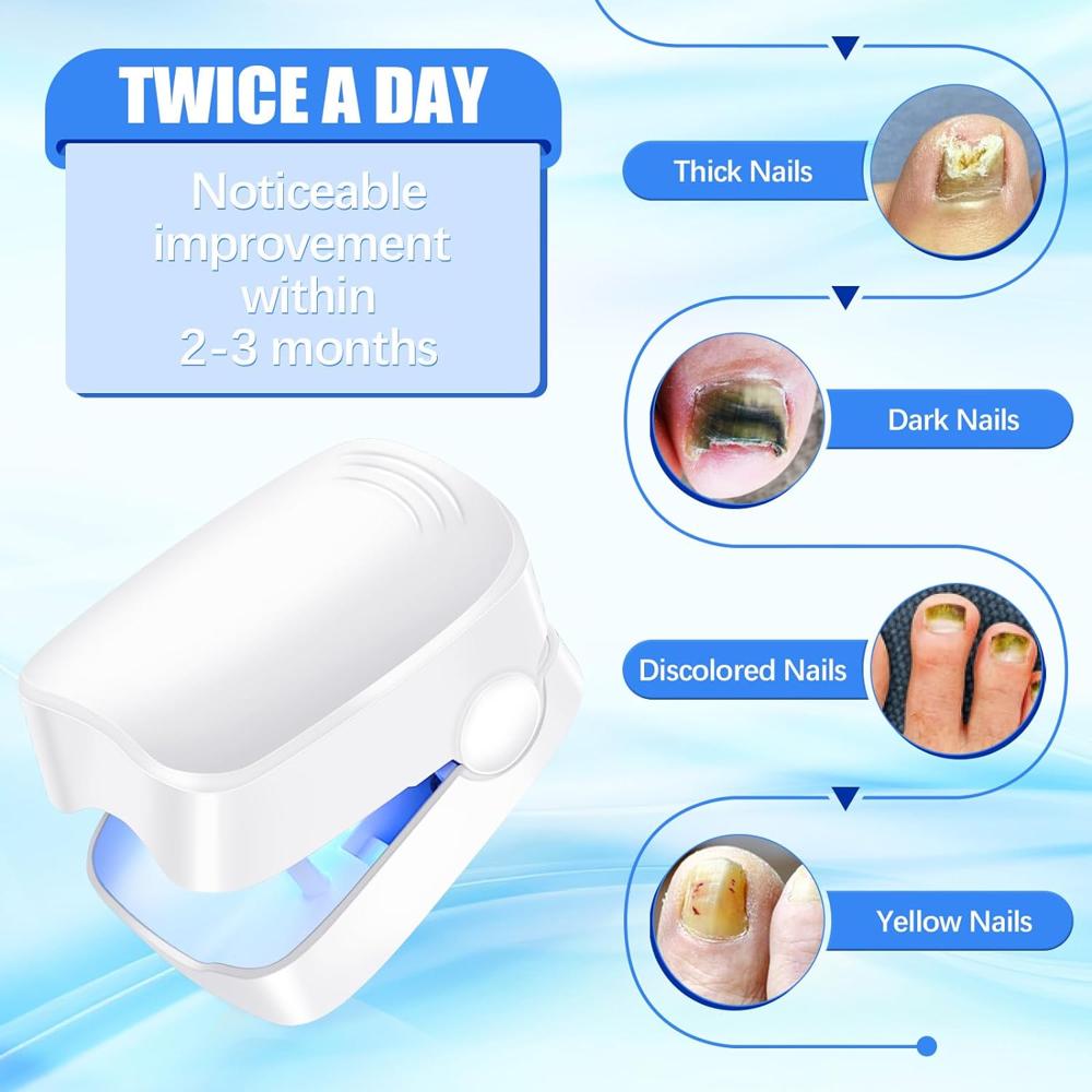 Rechargeable Nail Fungus Laser Anti Fungal Device Toenails, Hands, Feet (Home Use)