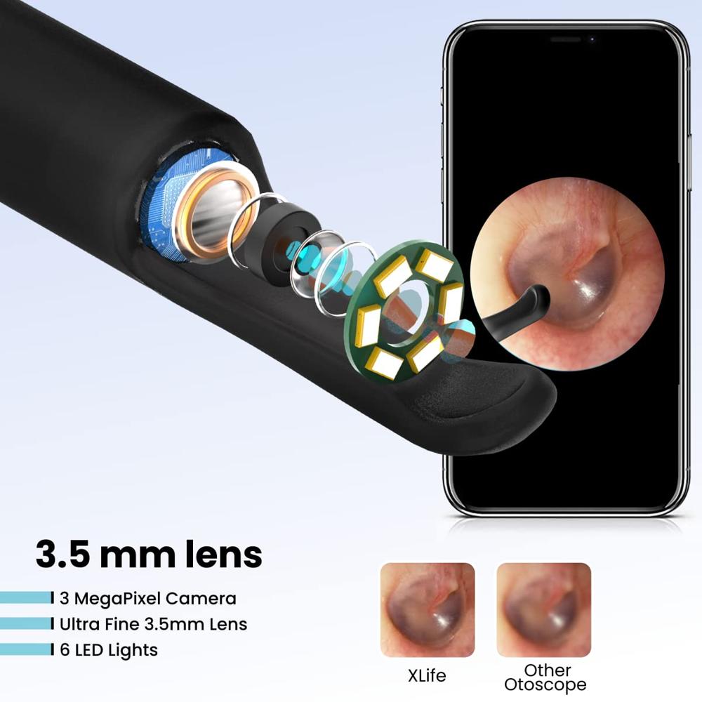 Portronics Xlife Smart Wireless Ear Otoscope Cleaner with 6 LED Lights,