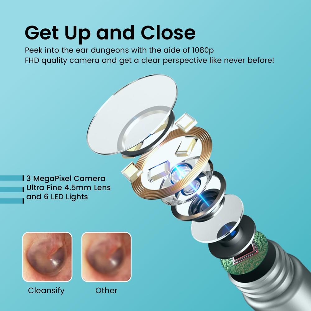 Portronics Cleansify Ear Endoscope Otoscope/Wax Cleaner with 1080p