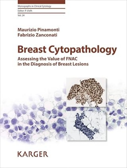 Breast Cytopathology Book