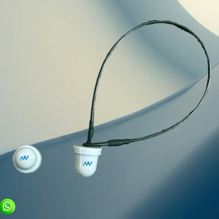 Loop Lock