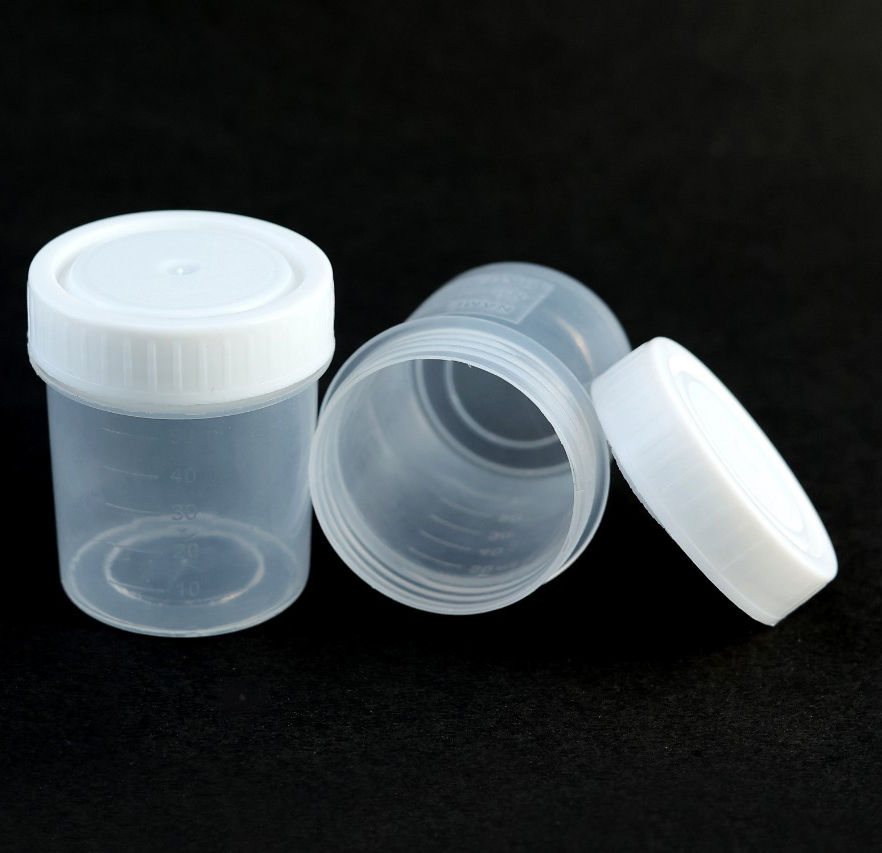 Non Sterile Urine Container