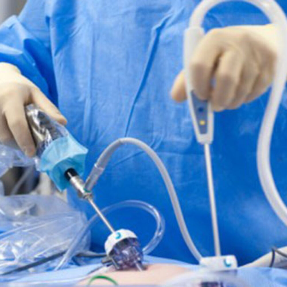 Sterilised Laparoscopy Camera Cover