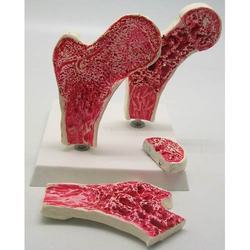 हड्डी के नुकसान को दूर करना आसान है