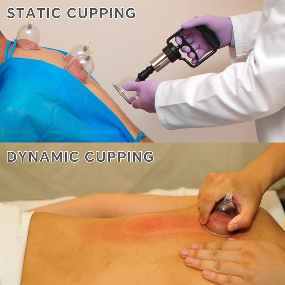 Vacuum Cupping Massager