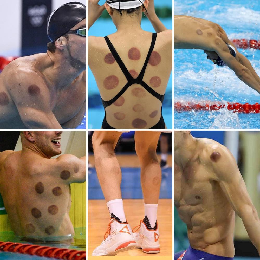 Vacuum Cupping Massager