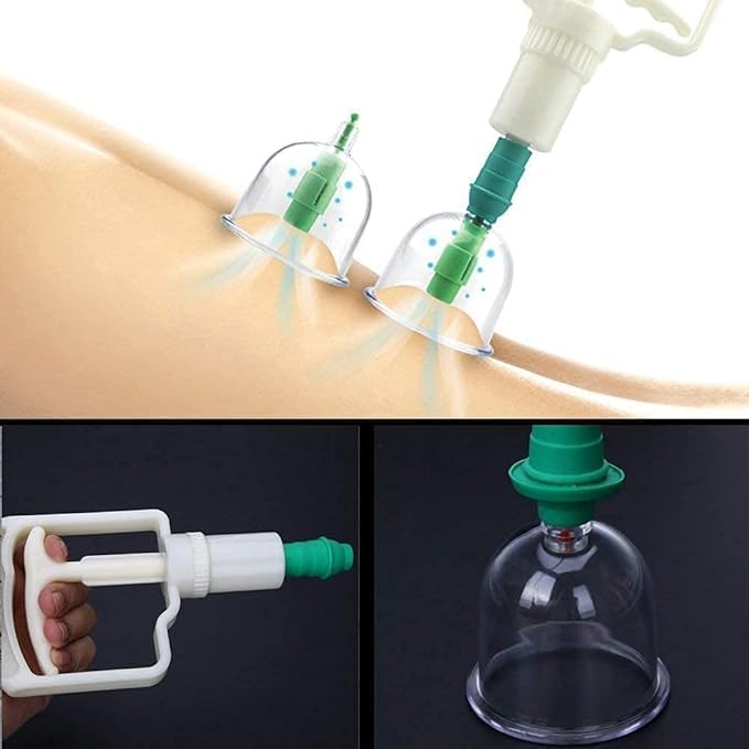 Vacuum Cupping Massager