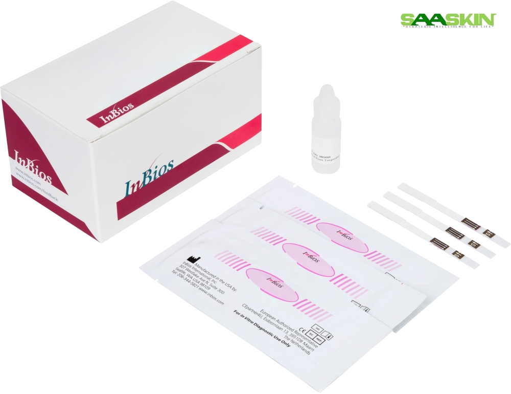 Inbios Kalazar Detect Rapid Test for Visceral Leishmaniasis