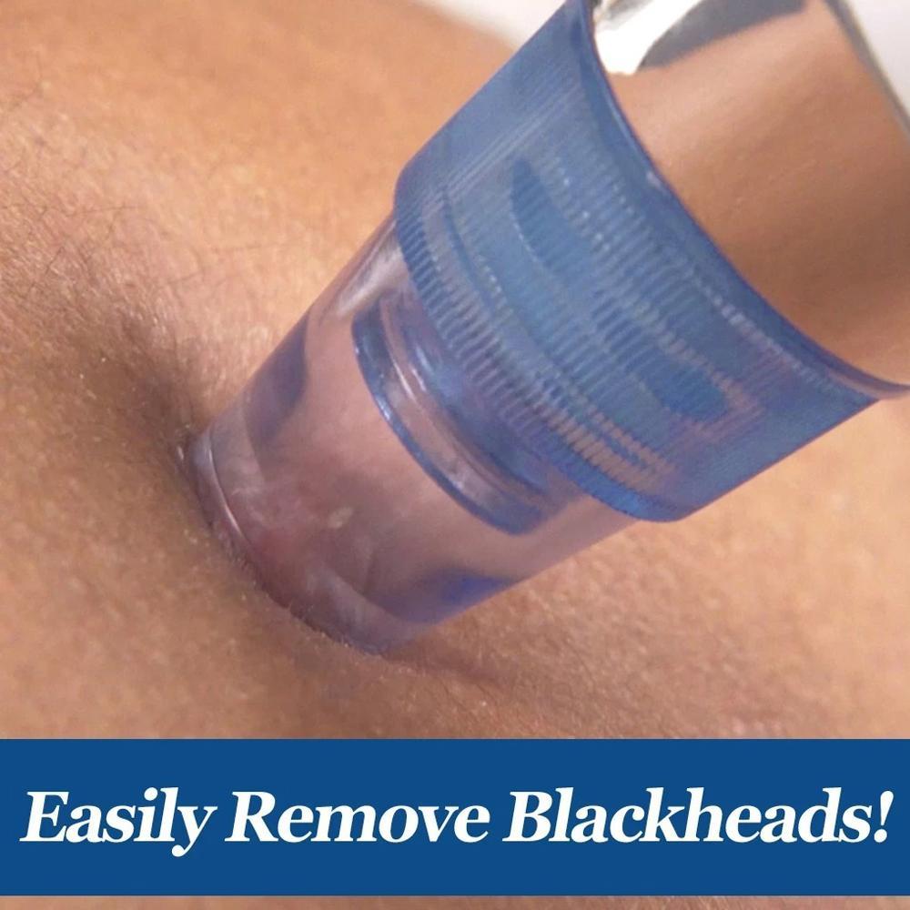 4-in-1 Blackhead Extractor  Vacuum Suction Acne Remover & Pore Cleaner