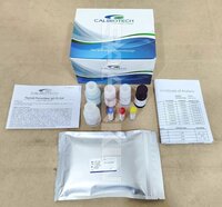 Calbiotech Thyroid Peroxidase (TPO) IgG ELISA
