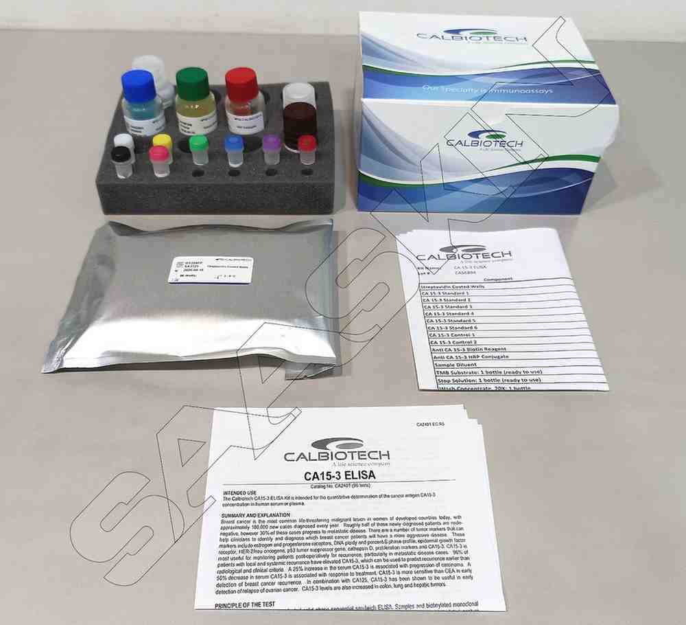 Calbiotech Cmv Igg Elisa - Plastic Reagents, 96 Wells | High Specificity, Sensitivity, Portable, 12-month Shelf Life