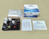 Chlamydia trachomatis IgM ELISA
