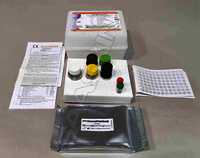 CTK Biotech RecombiLISA HAV IgM ELISA CE
