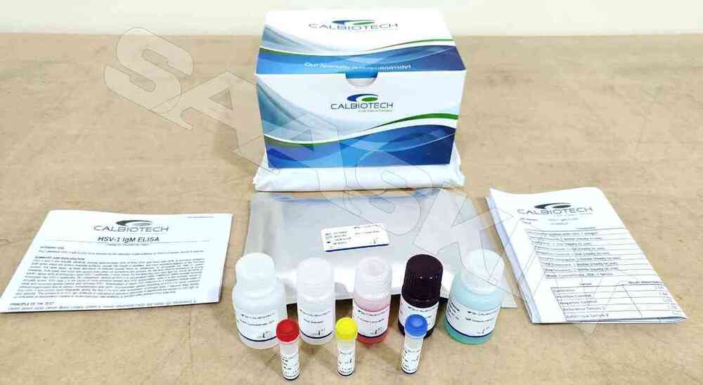 Calbiotech HSV-1 IgM ELISA
