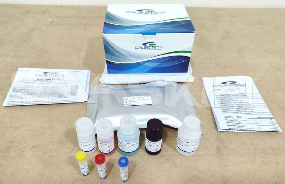 Calbiotech HSV-2 IgM ELISA