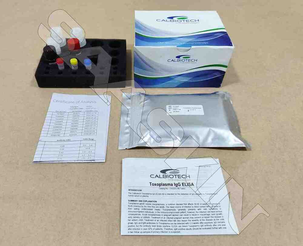 Calbiotech Toxoplasma IgG ELISA