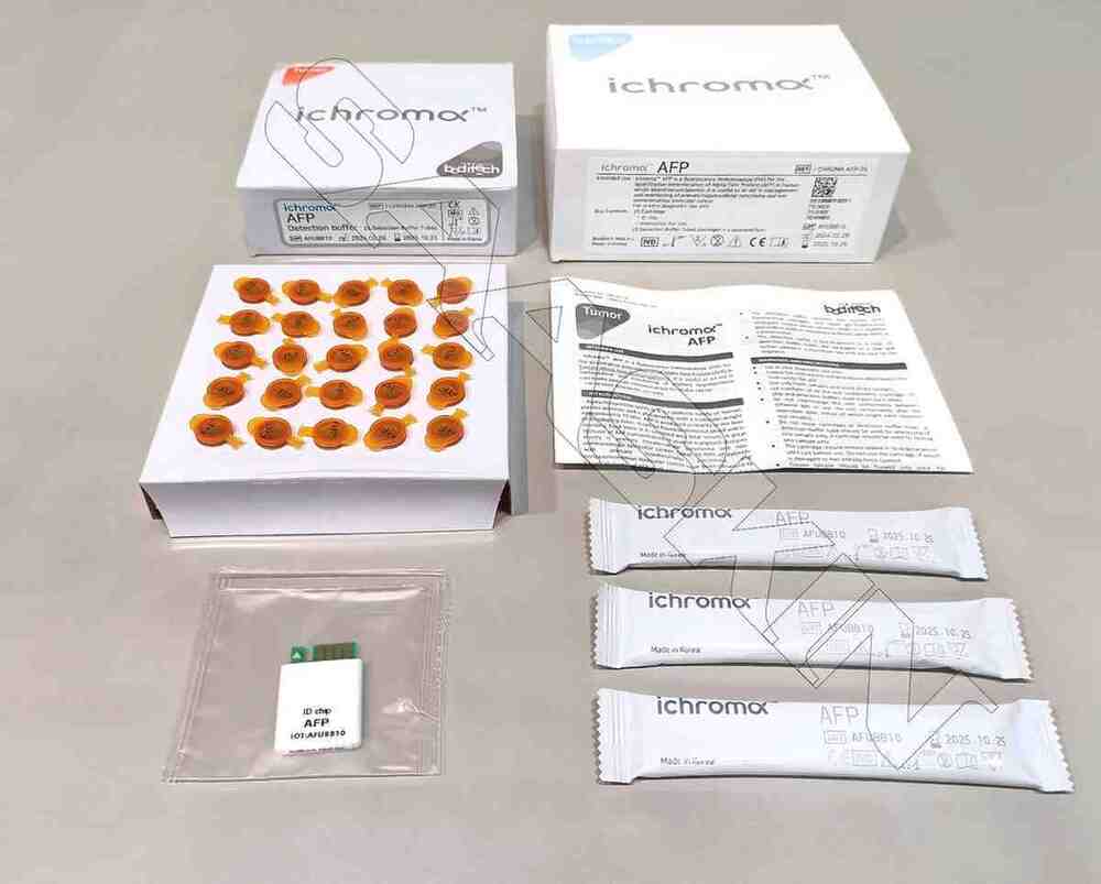 ichroma Alpha-Fetoprotein (AFP)