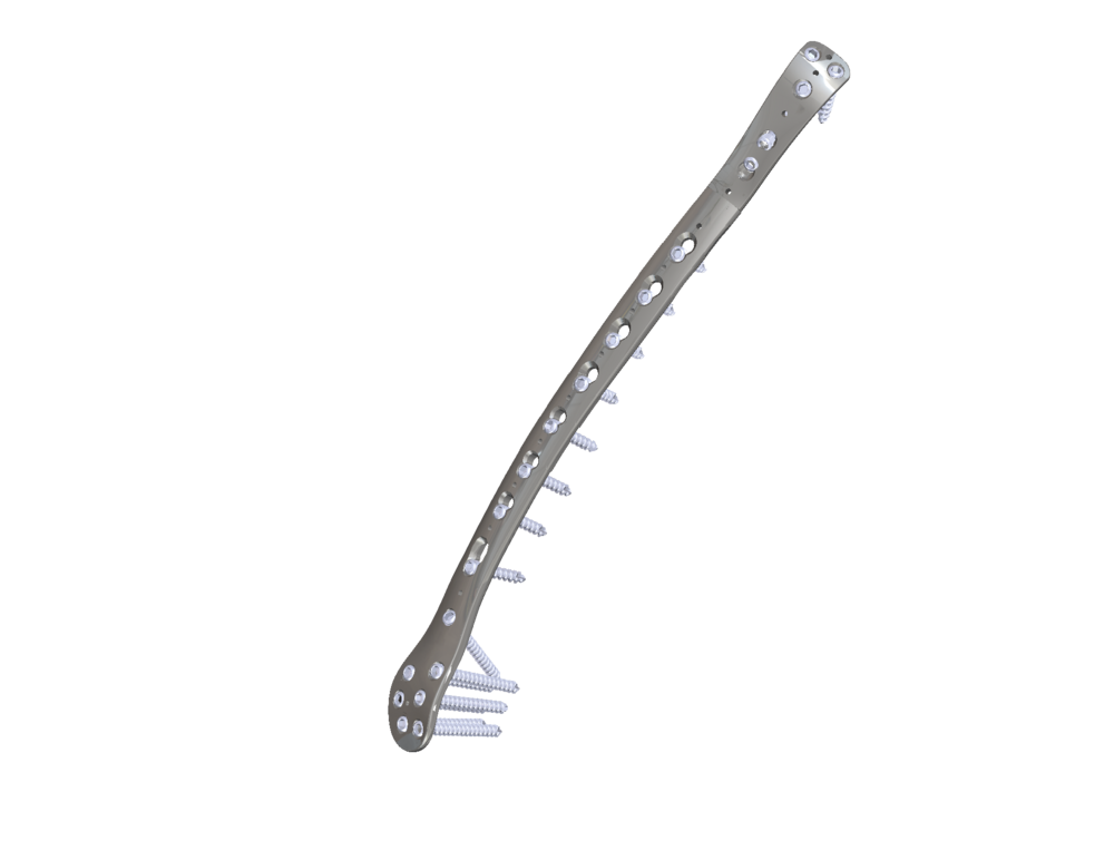 Customised Implants