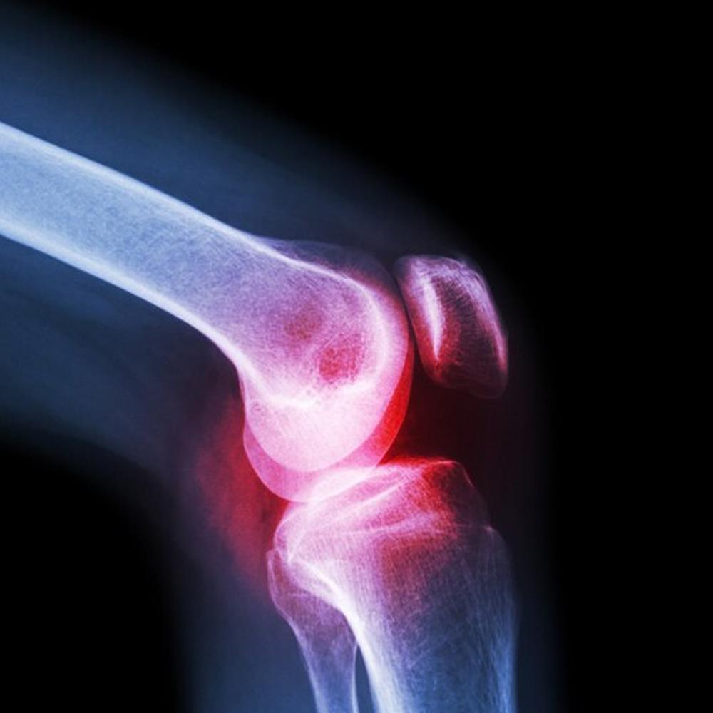 Knee Cap for Knee Support (Large)