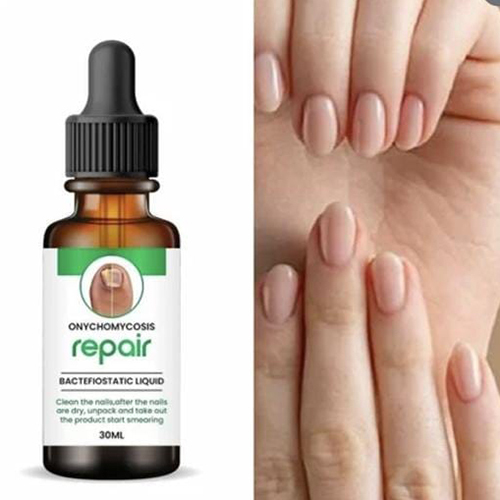 Nail Repair Nail Fungus Onychomycosis Bactefiostatic Liquid Solution 30Ml - Color Code: Transparent/Light Yellow