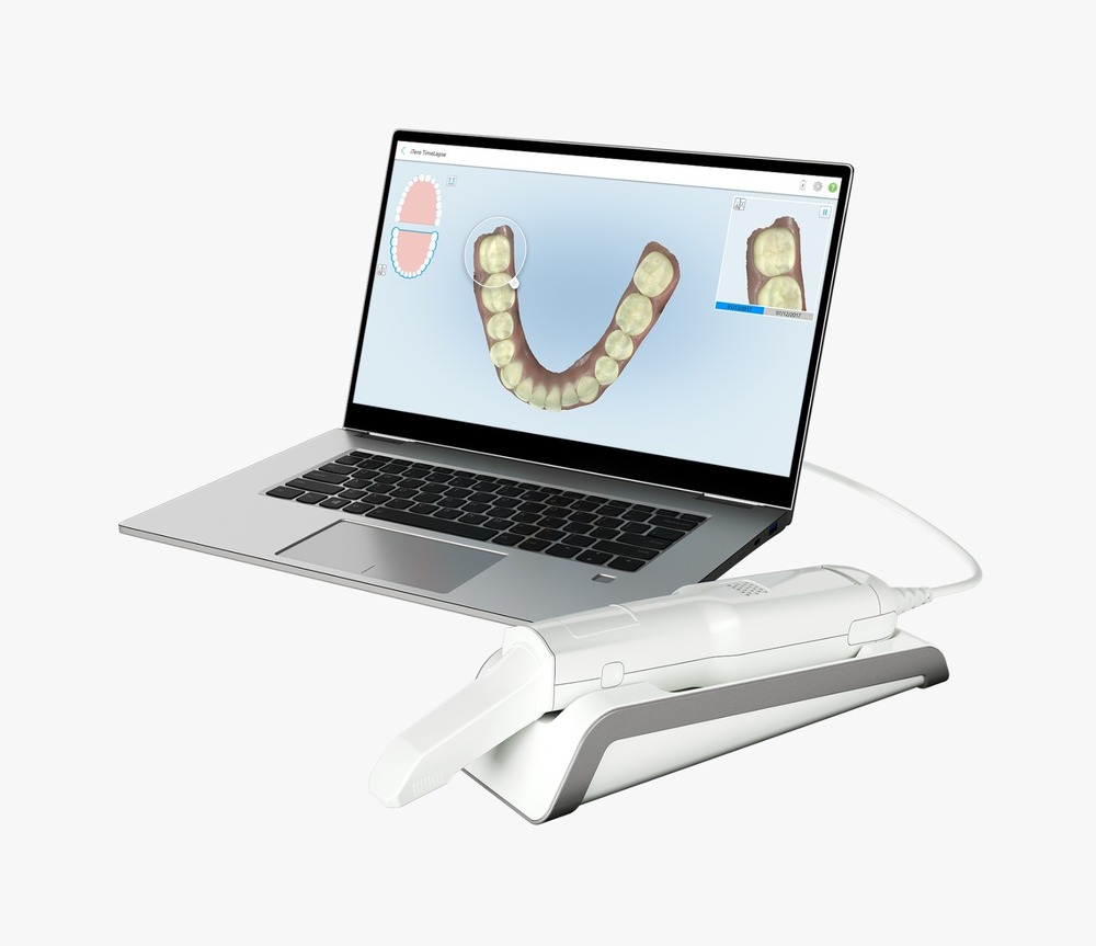 Flex Intraoral Scanner