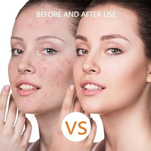 FACE AND NECK THERAPY BEAUTY MASK