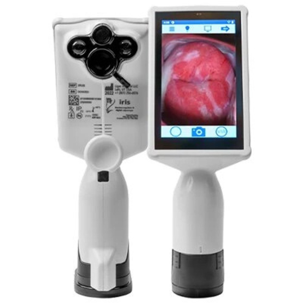 GyneBio Cervical Cancer Screening Device