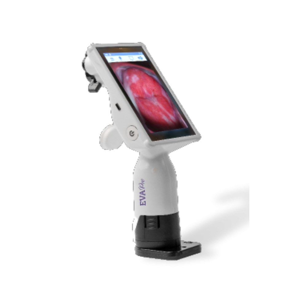 GyneBio Cervical Cancer Screening Device