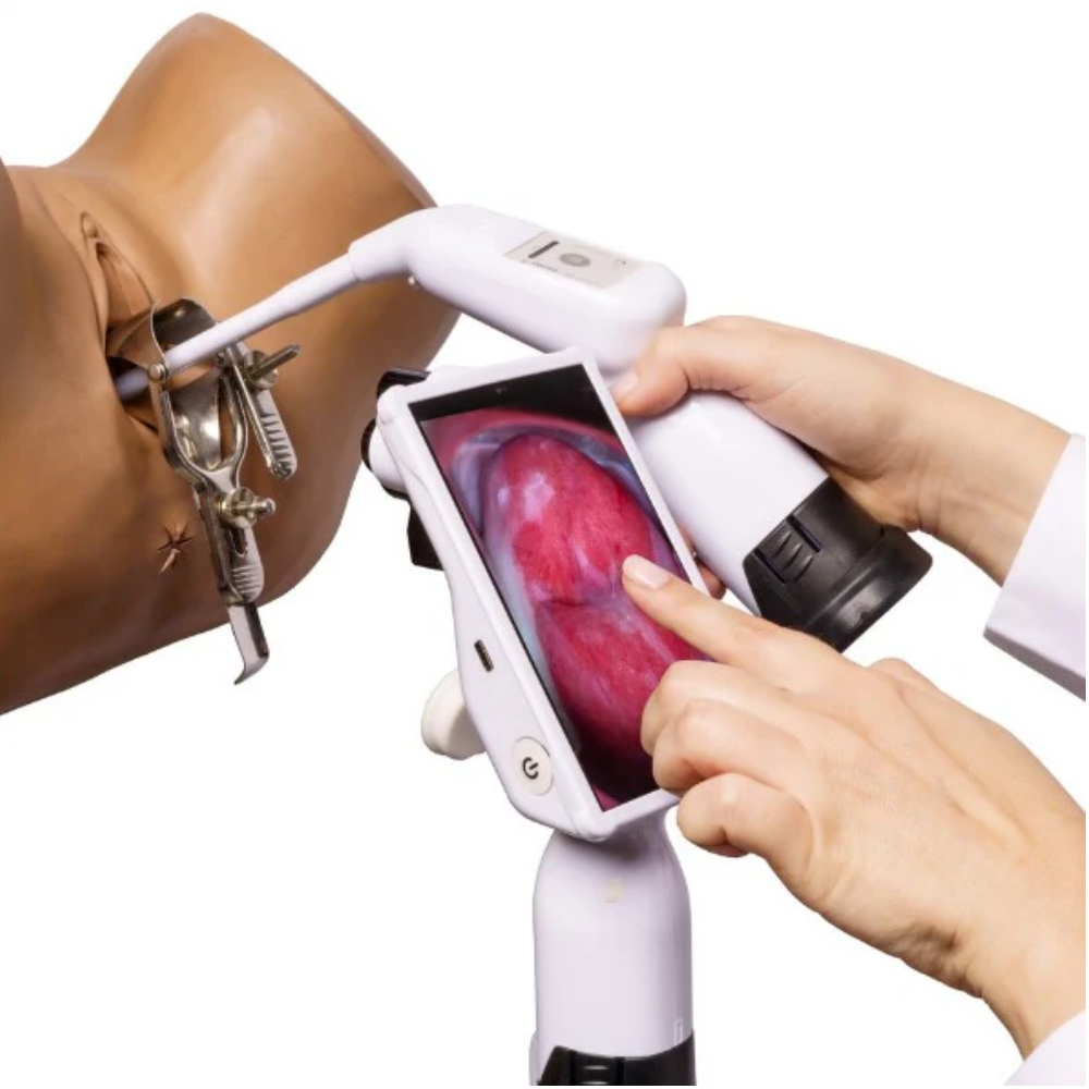 GyneBio Cervical Cancer Screening Device