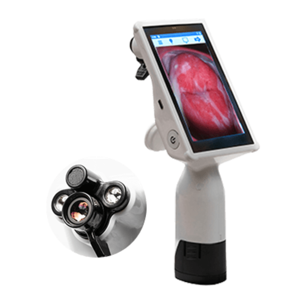 GyneBio Cervical Cancer Screening Device